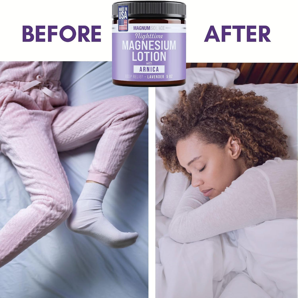 Magnum Solace Nighttime Magnesium Lotion with Arnica – Highly Concentrated Magnesium for Muscles & Joints – Apply to Legs or Feet Before Bed – Skin-Friendly