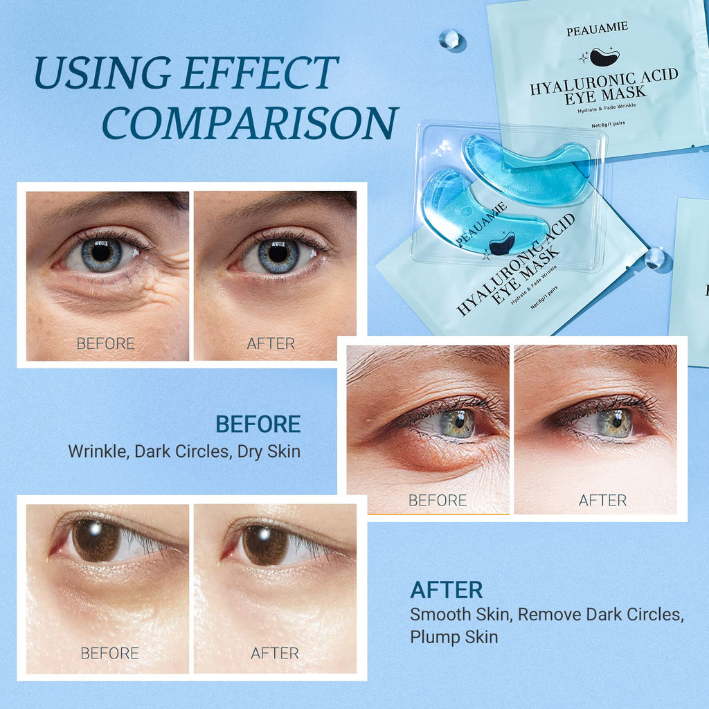 PEAUAMIE Under Eye Patches Gold and Hyaluronic Acid for puffy eyes,Rose Eye Masks for Dark Circles and Puffiness skin care Smooth Wrinkles products 30 Pairs